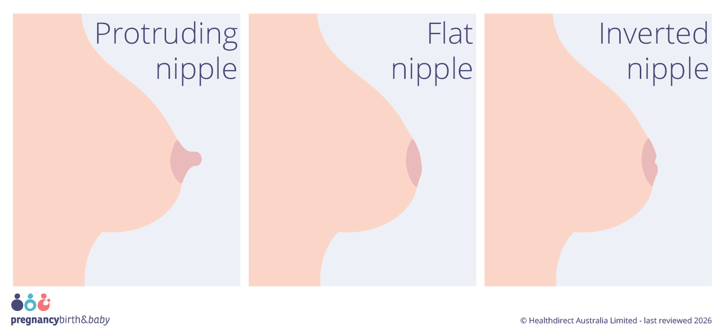 Protruding, flat and inverted nipples.