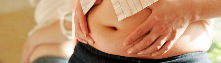 Woman with bloated stomach due to cortisol.