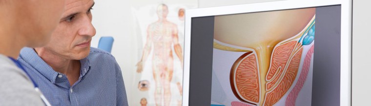 Men over 40 with a family history and all men over 50 should have screening according to current recommendations. Men over 40 with a family history and all men over 50 should have screening according to current recommendations.