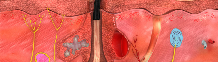 Illustration of human skin layers Illustration of human skin layers