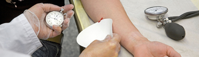 Measuring the blood clotting time of a patient. Measuring the blood clotting time of a patient.