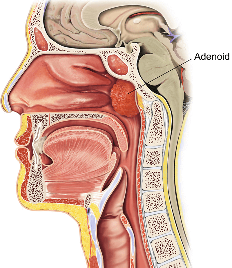 Location Of Adenoidsthe Structure Of The Nasopharynx