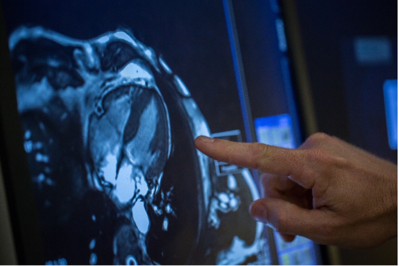 Visualising heart disease to reveal risk improves patient adherence ...
