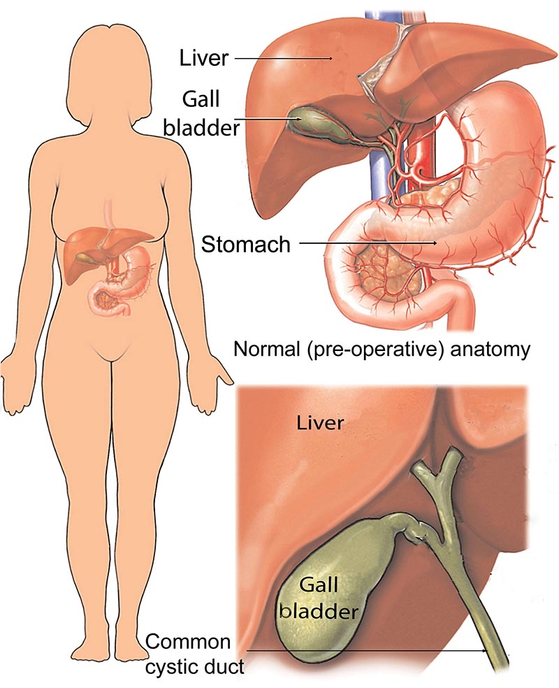 gallbladder pain location