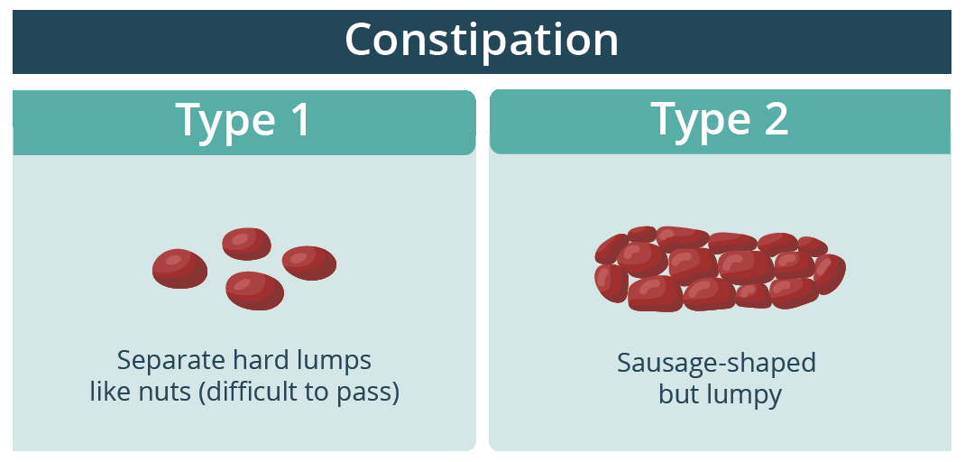 Illustration of types of poo's that could mean you are experiencing constipation.