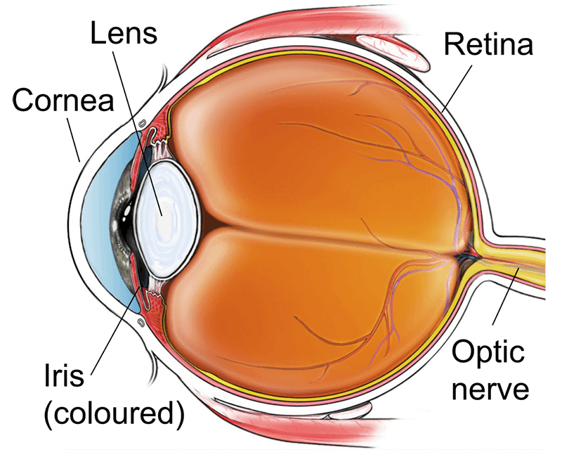 dendritic corneal ulcer