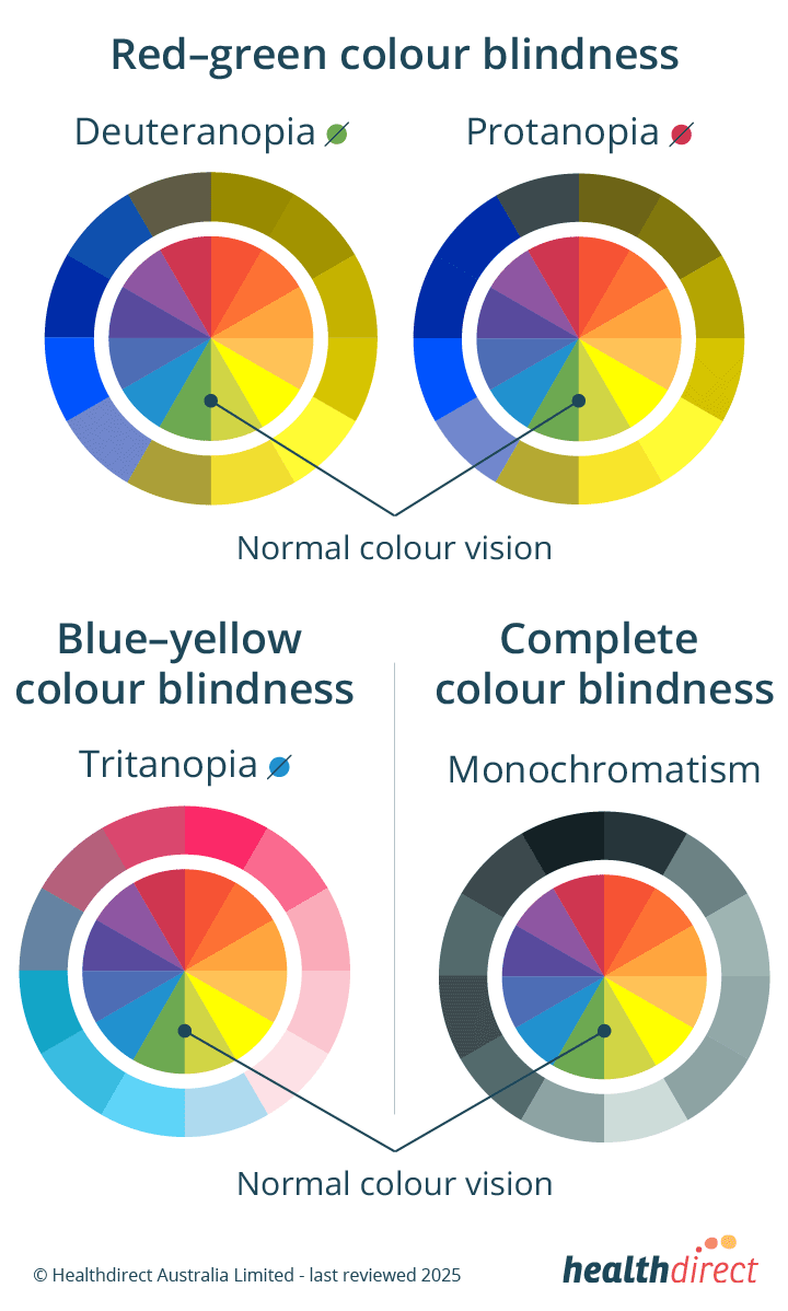 Colour Blindness Colour Vision Deficiency And Testing Healthdirect Colour Blindness Colour Vision Deficiency And Testing Healthdirect