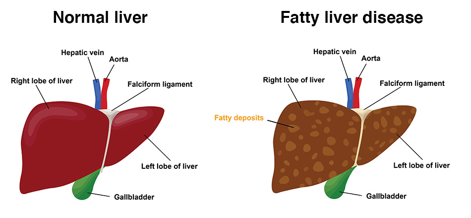 Bioglutide NA-931 liver | Shaanxi BLOOM Tech Co., Ltd Bioglutide NA-931 liver | Shaanxi BLOOM Tech Co., Ltd