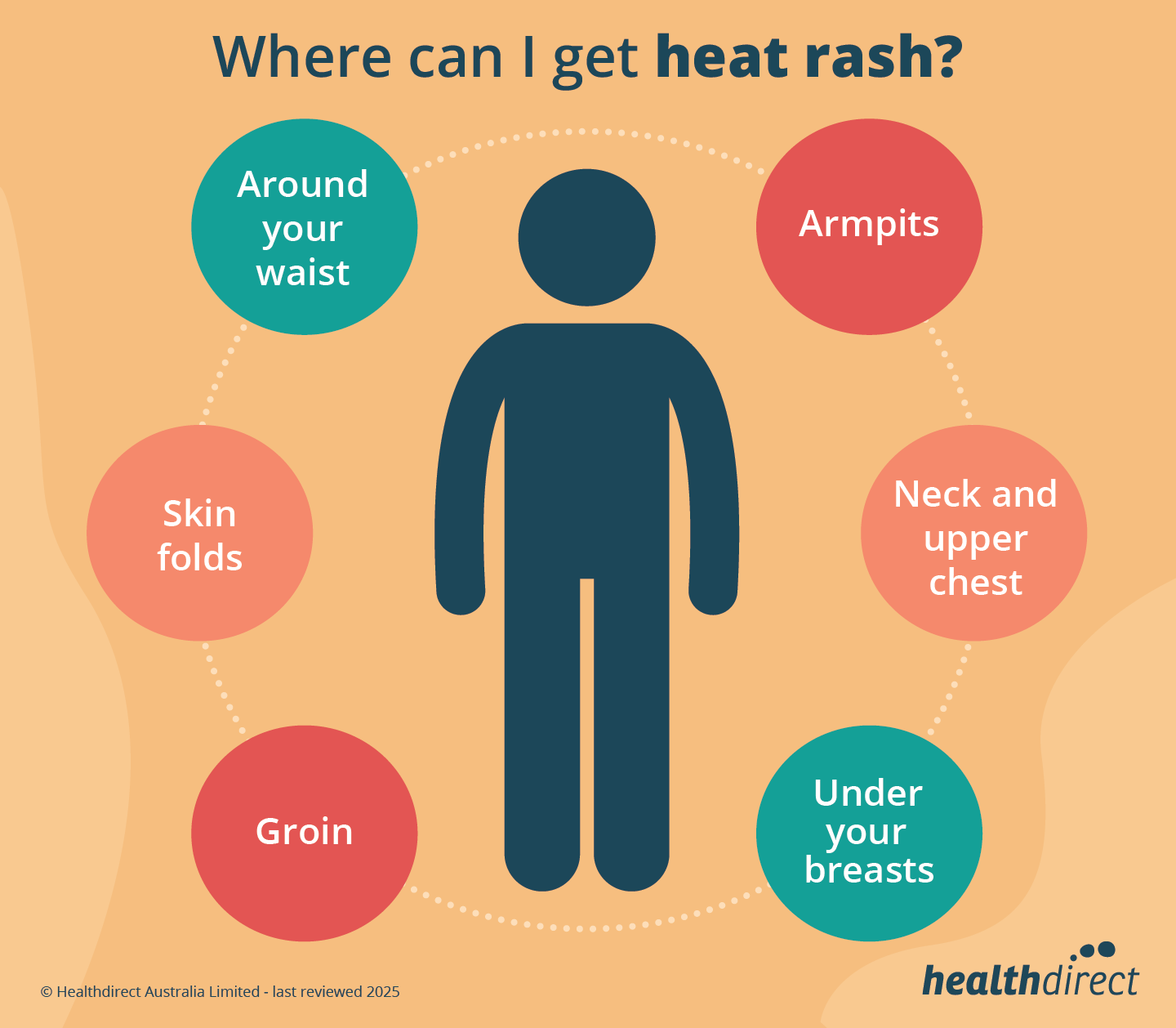 Heat rash occurs in places where sweat collects, such as; Back, Armpits, Waist, Elbow creases, Back of your knees, Chest, Groin and Under your breasts.