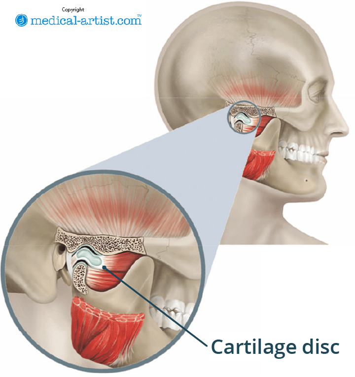 Illustration showing the temporomandibular joint.