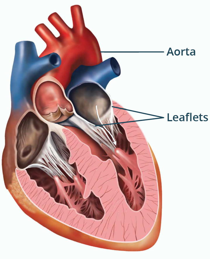 Illustration of an open mitral valve showing the aorta and leaflets.