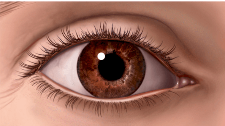 Illustration showing a normal eyelid.