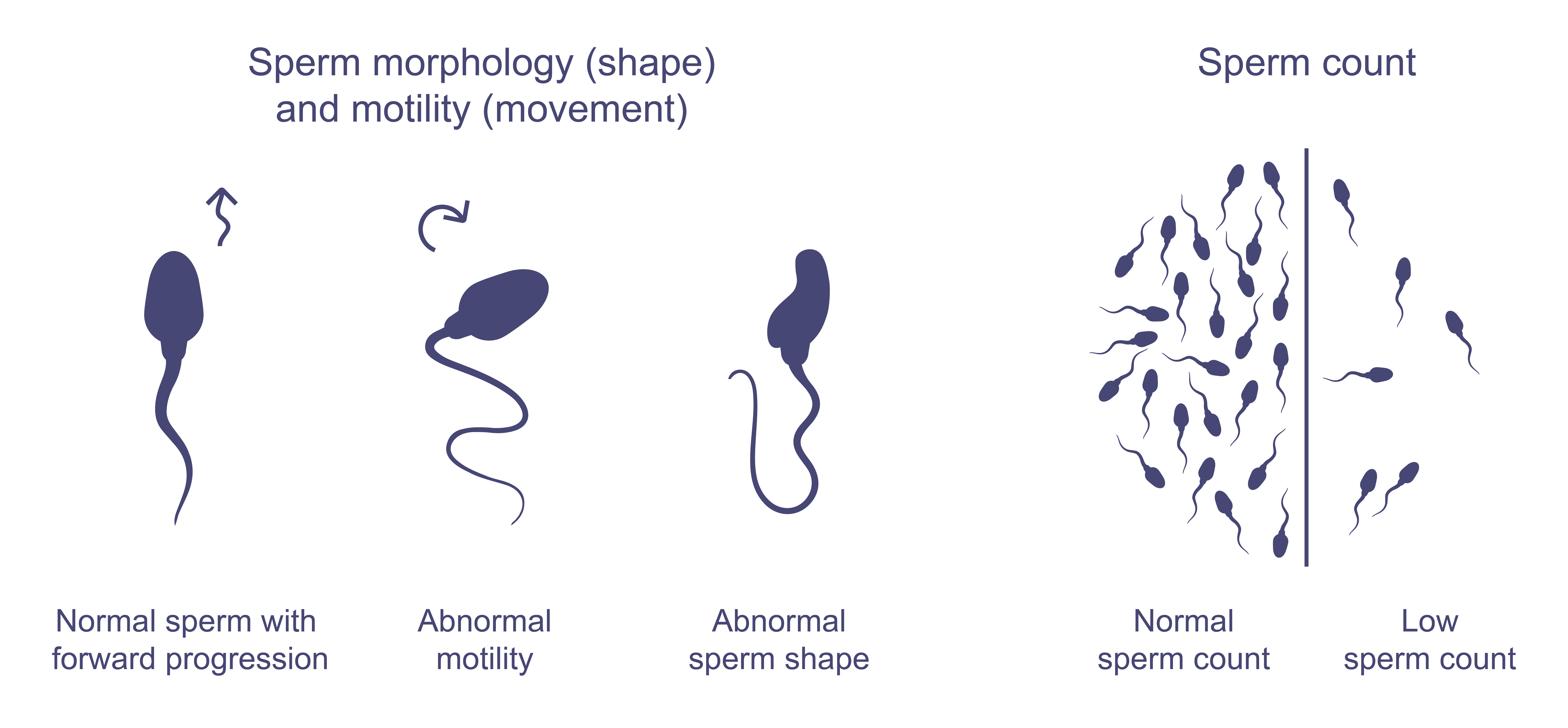 Infographic on sperm health, showing examples of normal sperm movement (forward spiraling like a cork screw) and abnormal movement (zig zagging or circling in on itself), normal sperm shape (oval head with a long tail) and an abnormal shape (head or tail defects). Along with a side by side comparison of normal sperm count (at least 15million sperm per mL) and low sperm count.