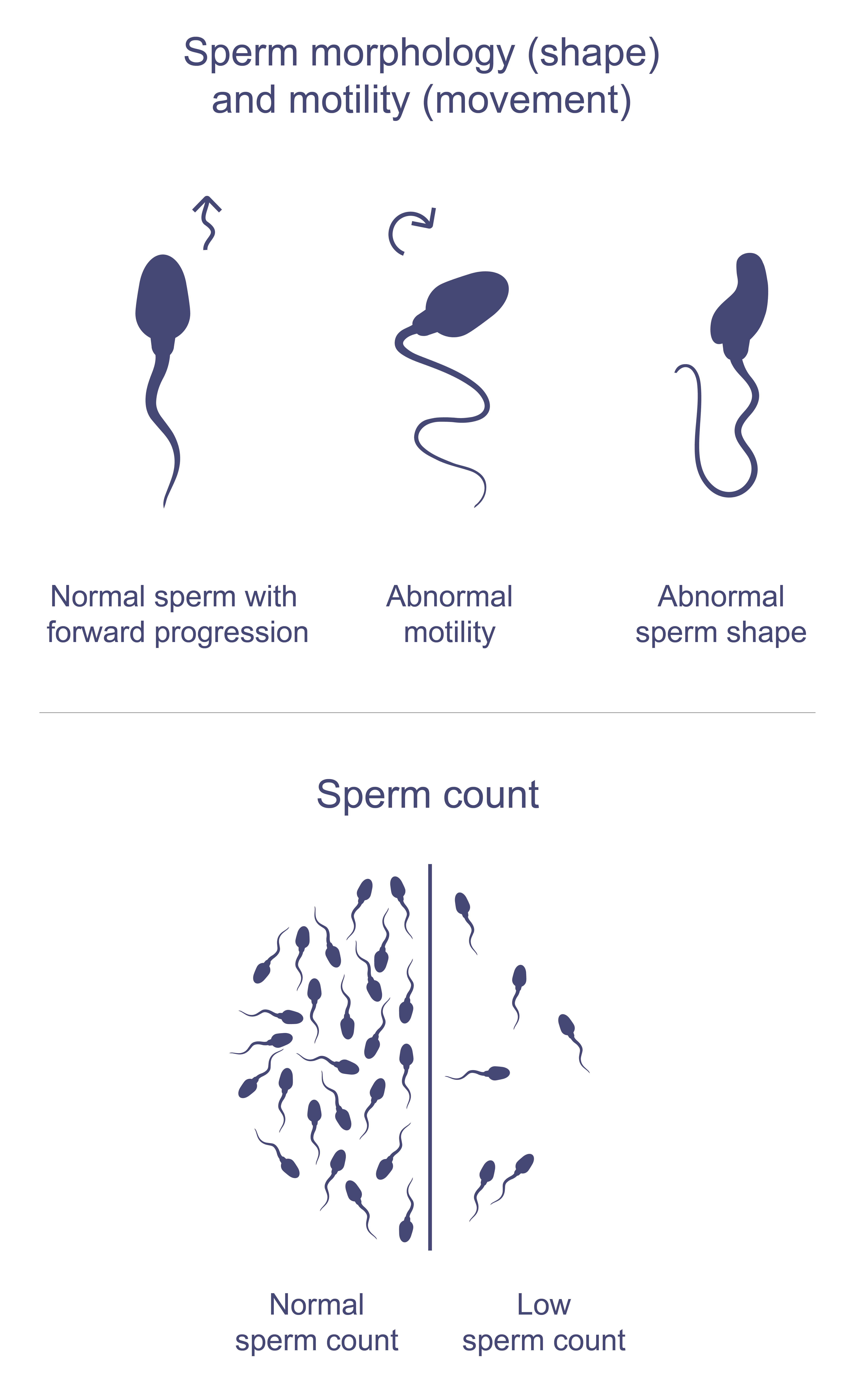 Infographic on sperm health, showing examples of normal sperm movement (forward spiraling like a cork screw) and abnormal movement (zig zagging or circling in on itself), normal sperm shape (oval head with a long tail) and an abnormal shape (head or tail defects). Along with a side by side comparison of normal sperm count (at least 15million sperm per mL) and low sperm count.