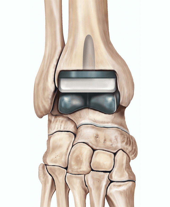 Replacement Revelations: Why Your Old Stuff Deserves a New Lease on Life