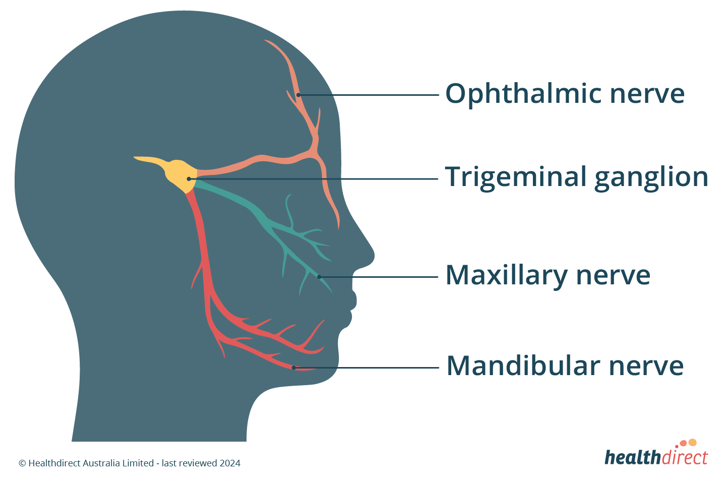 Illustration of the side profile of a head, with the 3 nerve branches highlighted. The ophthalmic nerve at the forehead, the maxillary nerve at the upper lip and cheek, the mandibular nerve at the lower teeth and jaw, and the trigeminal ganglion, which the above 3 nerves connect to in the brain.