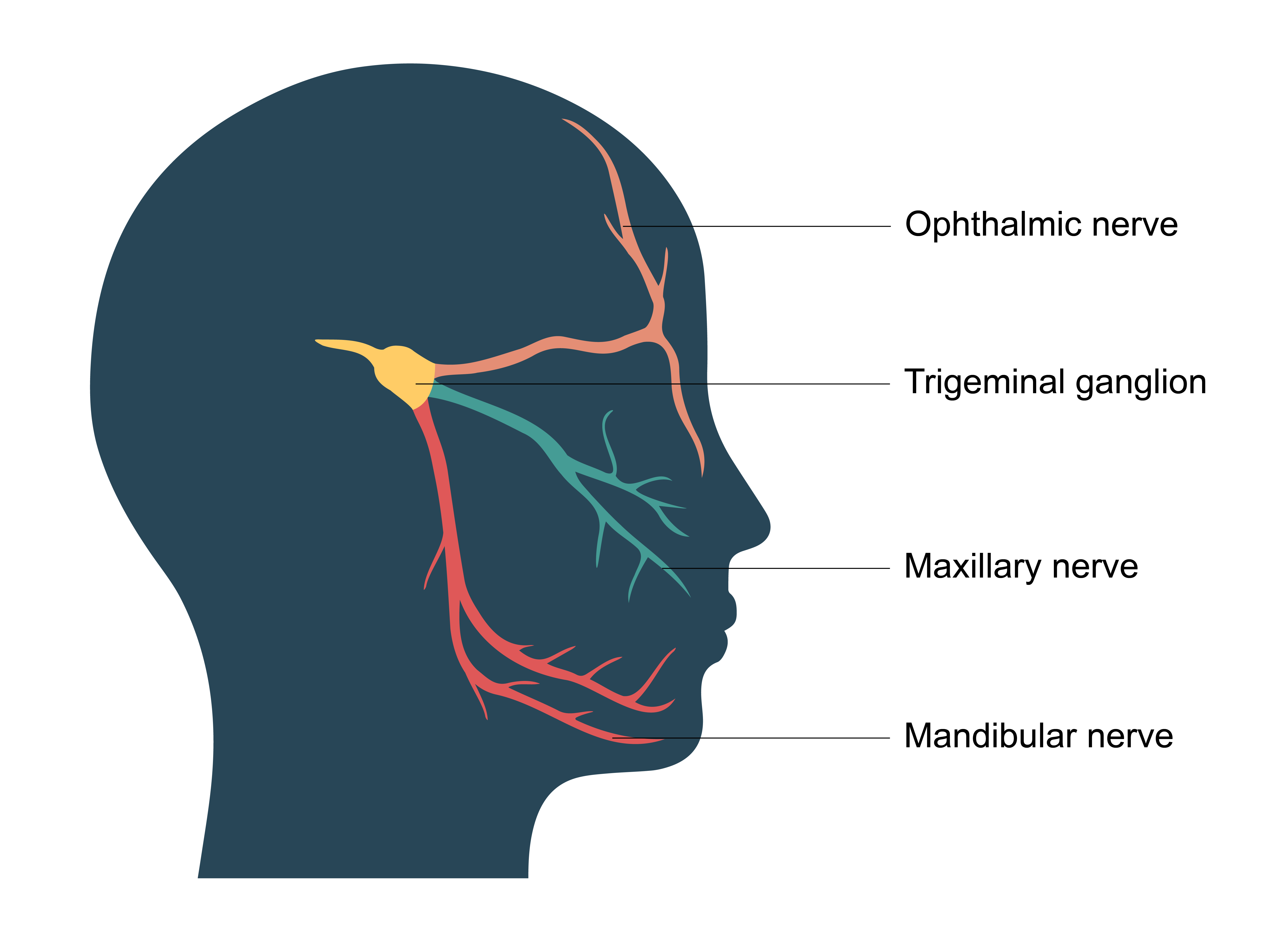 Facial Pain Trigeminal Neuralgia Cincinnati OH Mayfield 43 OFF