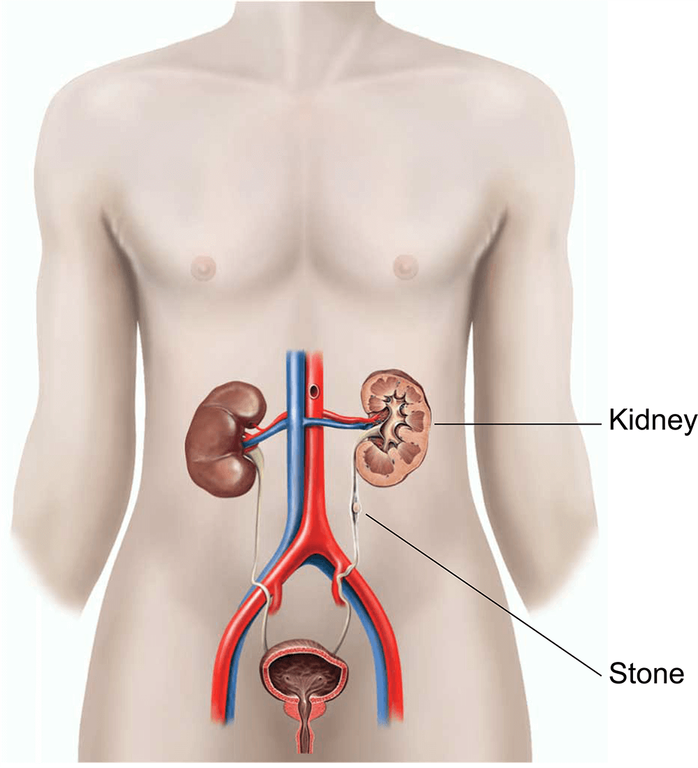 An illustration showing the position of the prostate gland.