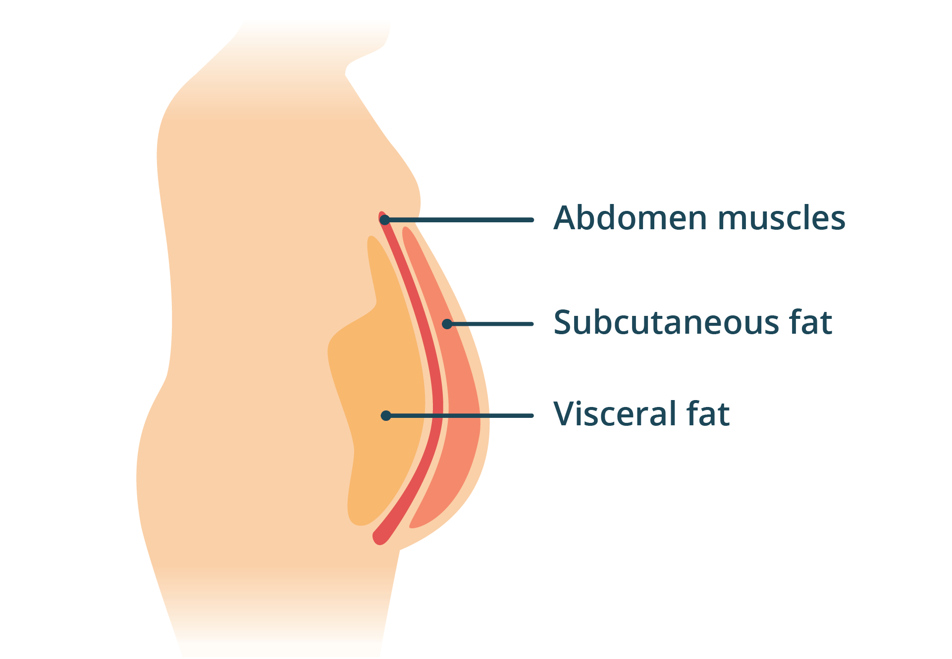 Illustration of showing the placement of visceral body fat, behind the abdominal muscles.