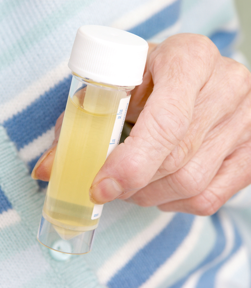 Urine tests | healthdirect