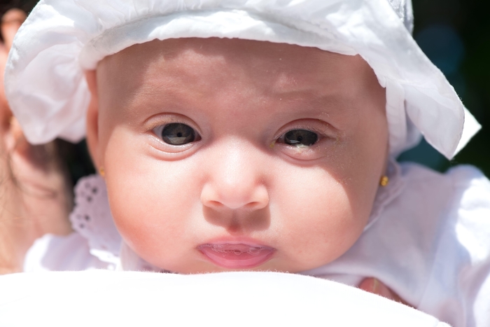 Baby puffy on sale under eyes