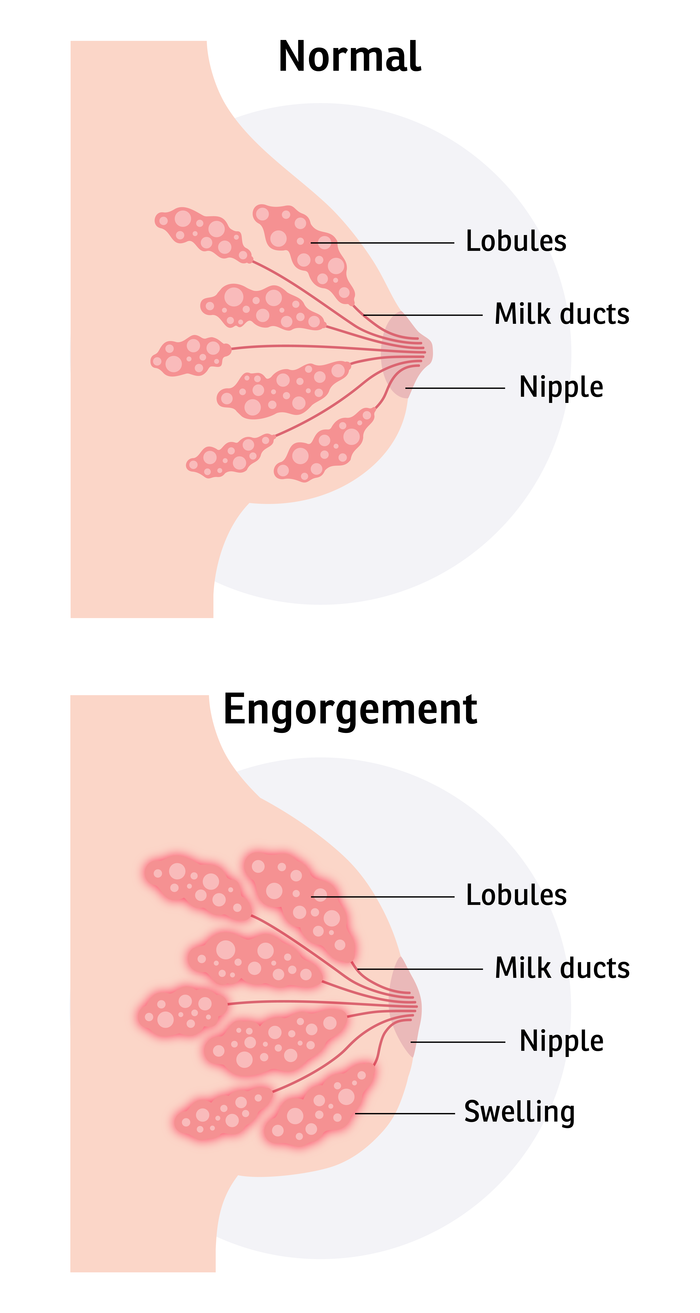 Puffy nipple lactation