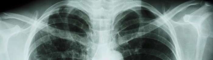 Lung conditions thumbnail